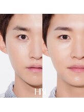 レア(LE’A)/新ハリウッドブロウリフト