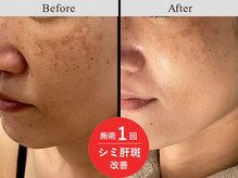 メディカルフェイシャルエステティック サロン ド ヴェリテ(VERITE)/