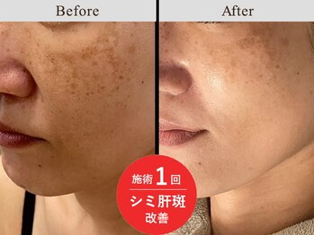 メディカルフェイシャルエステティック サロン ド ヴェリテ(VERITE)/