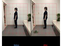 リード整骨院(LEAD整骨院)/姿勢改善、猫背、反り腰