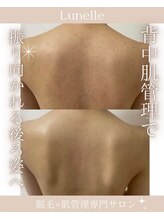 ルネル(Lunelle)/どこから撮られても綺麗に！