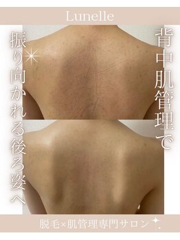 ルネル(Lunelle)/どこから撮られても綺麗に!