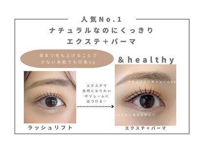 アイ ネイル スキン リリー(EYE NAIL SKIN Lily)の写真