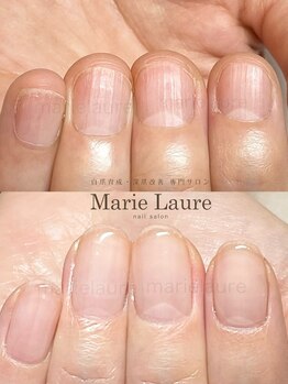 マリーロール 淀屋橋本店(Marie Laure)/自爪育成/深爪矯正/ネイルケア