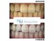 ホワイトニング モア(Whitening MORE)の写真