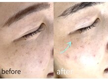 ルーム701(room701)/しみしわ年齢肌毛穴