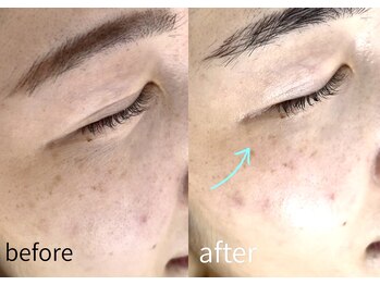 ルーム701(room701)/しみしわ年齢肌毛穴