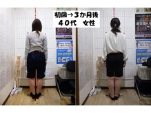 豊田まえやま接骨院/Ｏ脚矯正実績　４０代女性