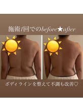 ウララカ(uraraka)/身体の不調もスッキリ！