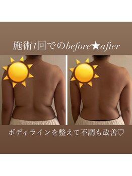 ウララカ(uraraka)/身体の不調もスッキリ！