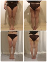 美人バスト 札幌店/ダイエット◇症例◇バストアップ