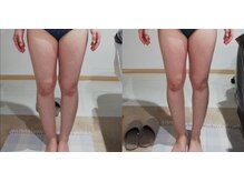 RiとBiのたまご/全身デトックス　オールハンド