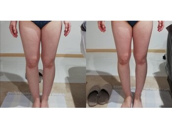 RiとBiのたまご/全身デトックス　オールハンド