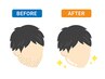 男性専用☆全身脱毛【顔かVIO含む】¥11,000⇒￥7,000　所要時間120分～150分 