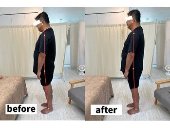 ヘルシールーム 六本木7丁目店(Healthy room)/before/after【慢性疲労】