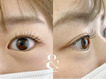 ムニ(muni)/&healthy【アンドヘルシー】