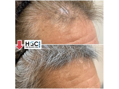 HGCラボ 新橋店の写真