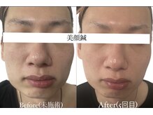 ヘッドサイエンス(HEADSCIENCE)/完全プライベート空間4