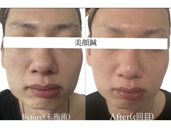 ヘッドサイエンス(HEADSCIENCE)/完全プライベート空間4