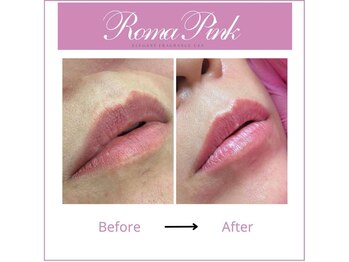 リリーガーデン 手稲店(Lily Garden)