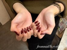フロムネイルアンドアイラッシュ 神戸三宮(from nail&eyelash)/パラジェル取扱/フィルイン施術