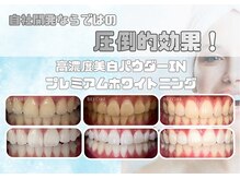 ホワイトニングが初めての方も安心★丁寧なカウンセリング◎