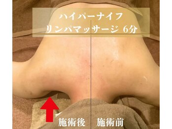 トータルボディサロン グリーン 日本橋駅前店(Green)/ハイパー×リンパマッサージ