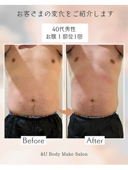 アンドユー(&U)/