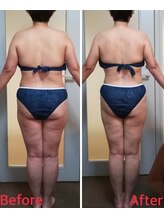 ダイエット サポート(DIET SUPPORT)/短期＆グロッティ　施術結果