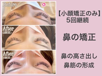 アンリエッタ(Unlieta)/【お鼻の変化】