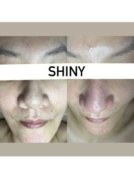 シャイニー(SHINY)/30代女性
