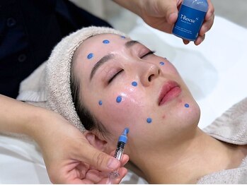 ボーテスキンクリニックの写真/【肌荒れ・乾燥・赤みに】肌バリア強化×美肌菌育成ケアでつるぴか肌へ