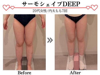 スパイア(SPIRE)/サーモシェイプDEEP★内太もも