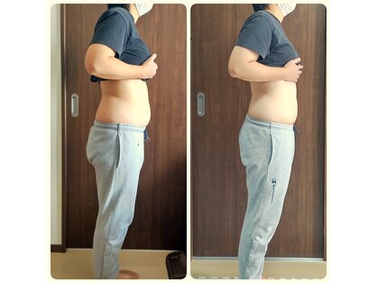 陽月 鍼灸院整骨院の写真