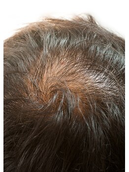 ザ レディービー(The Lady B)/ヘッドスパ