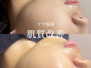 ラティエ(Latier)/ツヤ爆誕♪ハーブピーリング