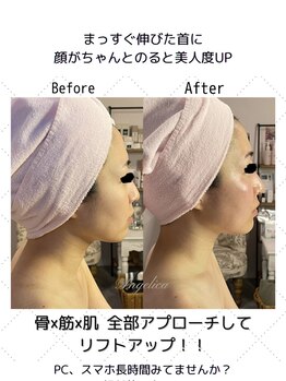 アンジェリカ(Angelica)/ストレートネック/姿勢が悪い