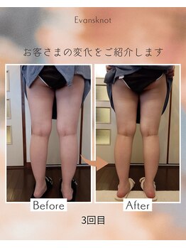 エバンス ノット(Evans knot)/美尻美脚コース3回目