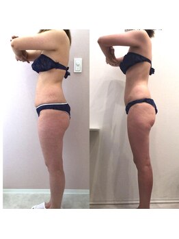 リラパドマ 千葉店(Rela Padma)/激痩せ短期集中ダイエットコース