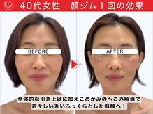那賀洋子式 顔ジム 大分戸次店/40代女性顔ジム1回の効果