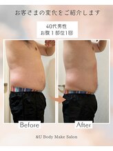 アンドユー(&U)/