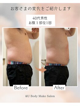 アンドユー(&U)/