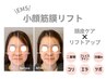 【頭・顔・首肩こりケア】EMS小顔筋膜リフト　60分