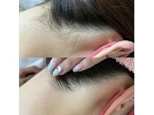 脱毛専門サロン エリクサー(Elixir)の雰囲気（後ろ姿も映えるうなじ脱毛♪）
