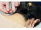 十全鍼灸院の写真/ガチガチの首肩こりを遠隔部のツボから改善。これぞ鍼灸施術ならではのアプローチ。
