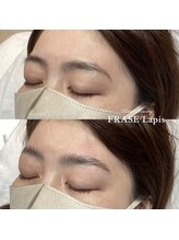 フレイズラピス(FRASE Lapis)/【ハリウッドブロウリフト】