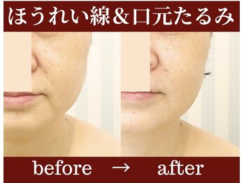 ガーデン(Garden)/