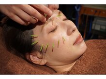 きわみ鍼灸整骨院 博多院/眼精疲労や肌質改善に