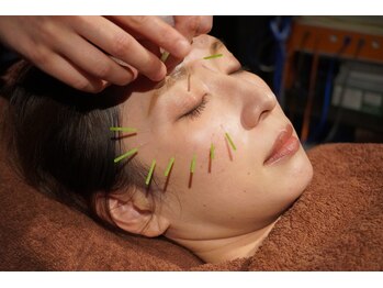 きわみ鍼灸整骨院 博多院/【博多駅】眼精疲労や肌質改善に