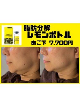 小顔になりたい